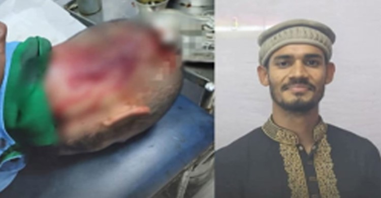 রাজারহাটে শিবির সভাপতির ওপর হামলার অভিযোগ, এলাকায় উত্তেজনা