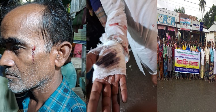 কুড়িগ্রামে ইউপি চেয়ারম্যানের উপর হামলা ও ছুরিকাঘাতের প্রতিবাদে বিক্ষোভ ও মানববন্ধন